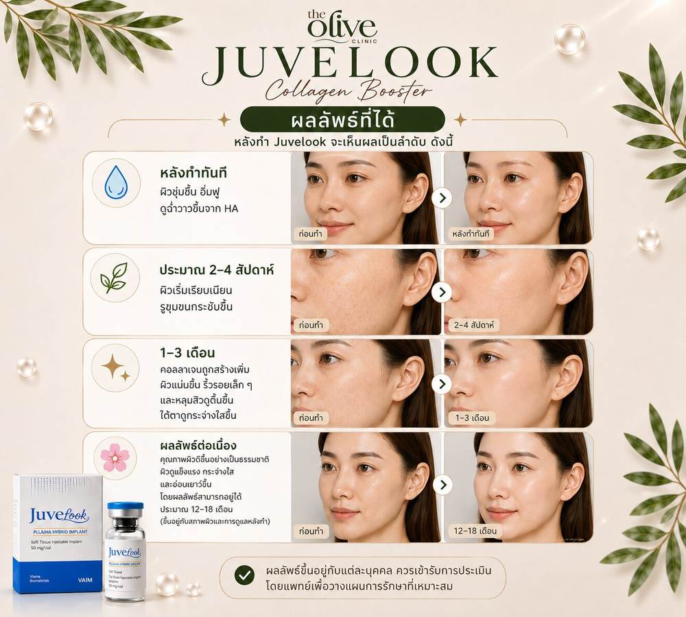 ผลลัพธ์ที่ได้หลังทำ Juvelook