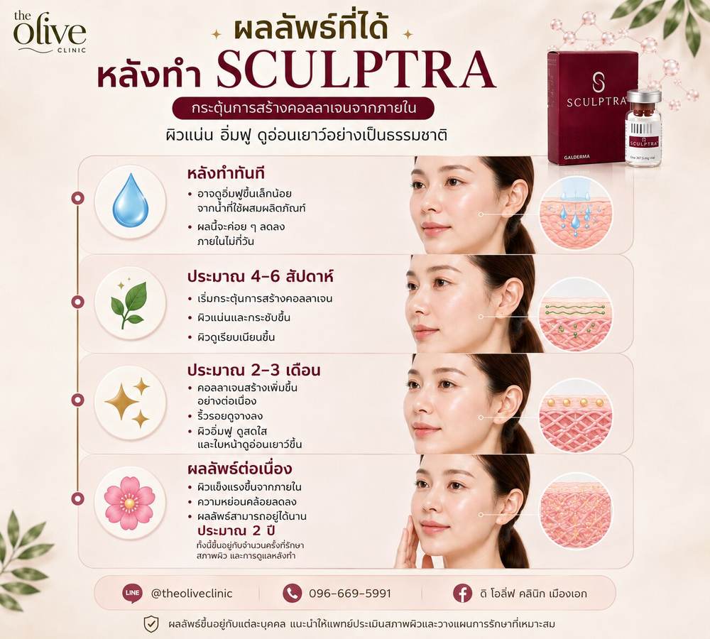 ผลลัพธ์ที่ได้หลังทำ Sculptra