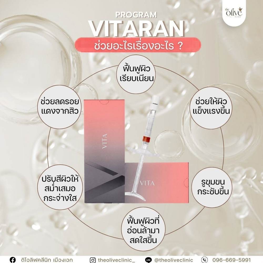 Program Vitaran ช่วยอะไรเรื่องอะไร ฟื้นฟูผิวเรียบเนียน ลดรอยแดงจากสิว